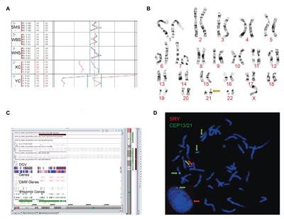 Application of FF-QuantSC for the Precise Estimation of Fetal Fraction in Non-invasive Prenatal Testing in Two SRY-Translocation Cases